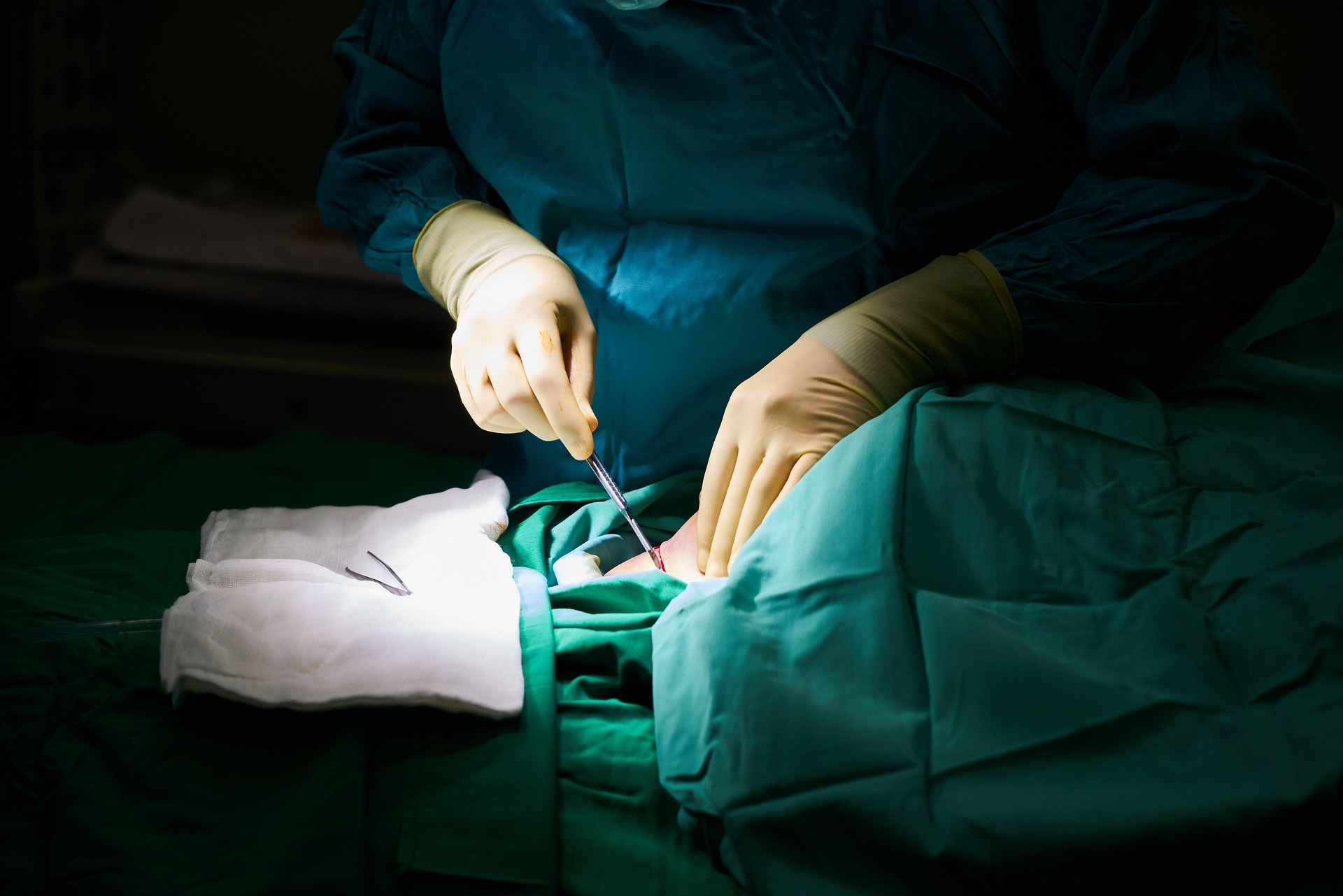 surgery-3034070_1920